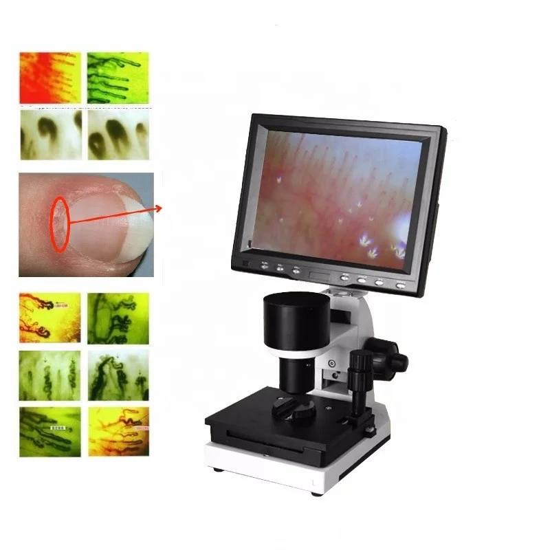 Nailfold capillary LCD Digital Microcirculation Microscope for health analyzsis