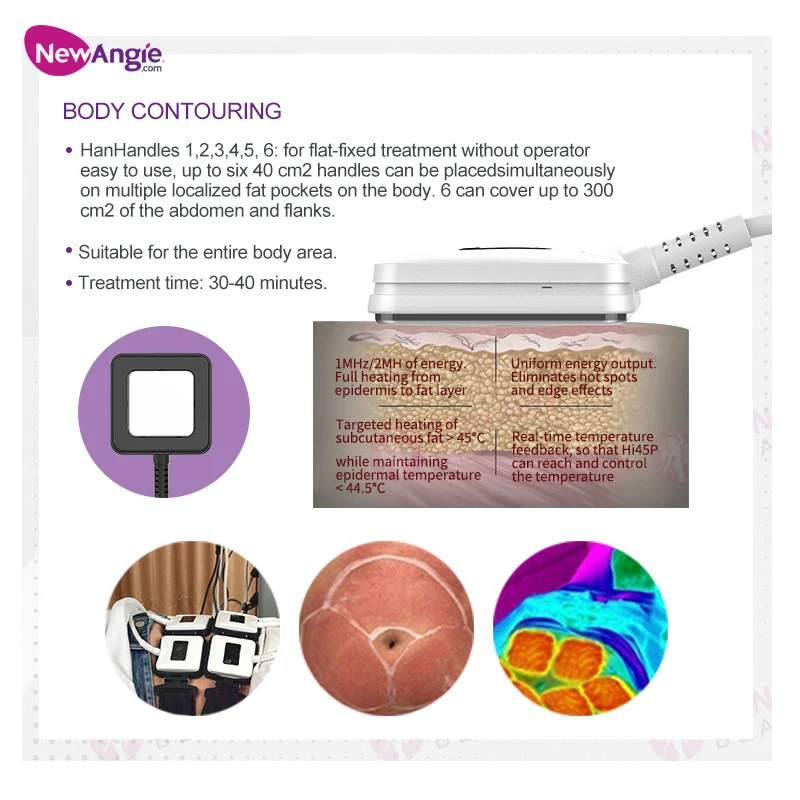 Newangie trusculpt  bodi  muscle  sculpt tighten machine trusculpt ID FLEX slimming trufat rf body slimming  448Kmachine