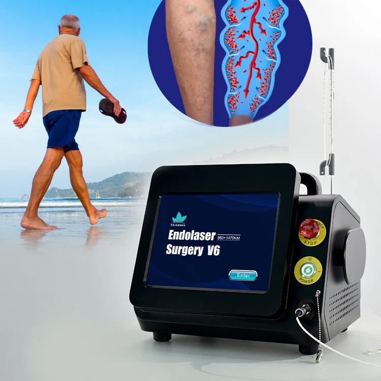Triangel Professional Varicose Veins Removal Treatment Radial 360 degrees Optical Fibers Diode Laser