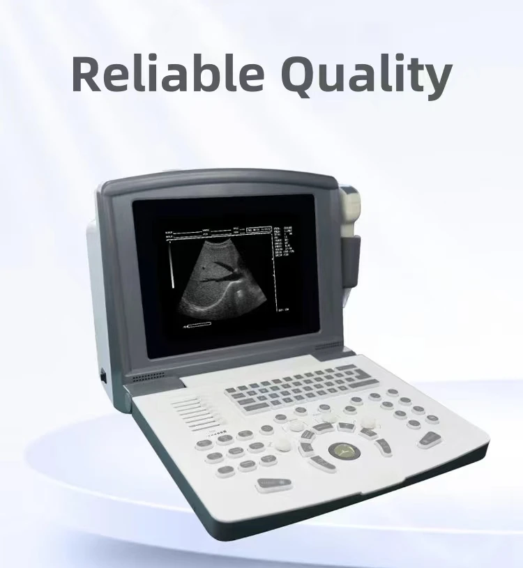 Full digital Manufacture CE Best price clinic Hospital  Portable Ultrasound Machine