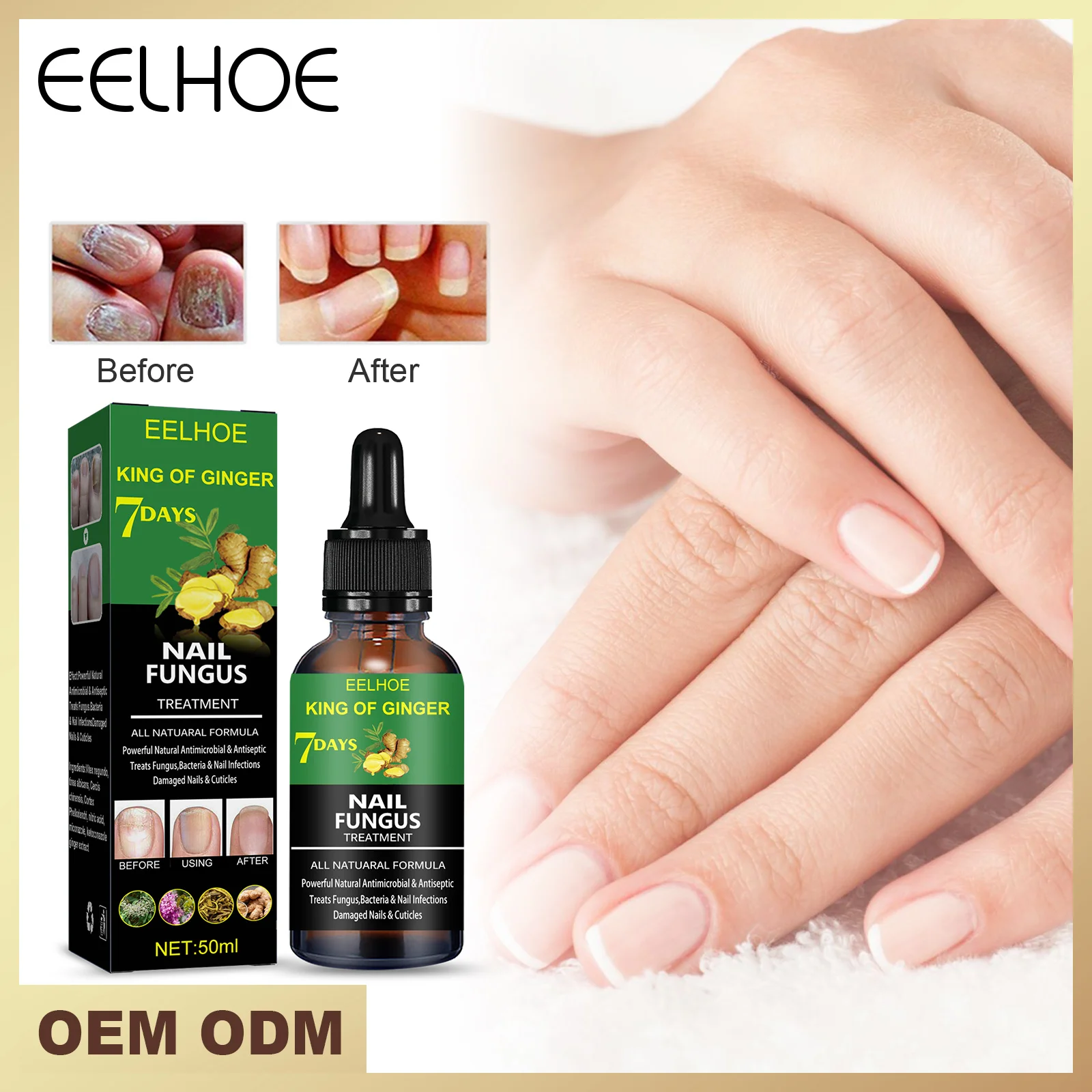 EELHOE 50ml New Herbal Care Hydrate Anti Fungal Nail Cream Quick Results Clean and Whiten Nail Repair Nail Fungus Treatment