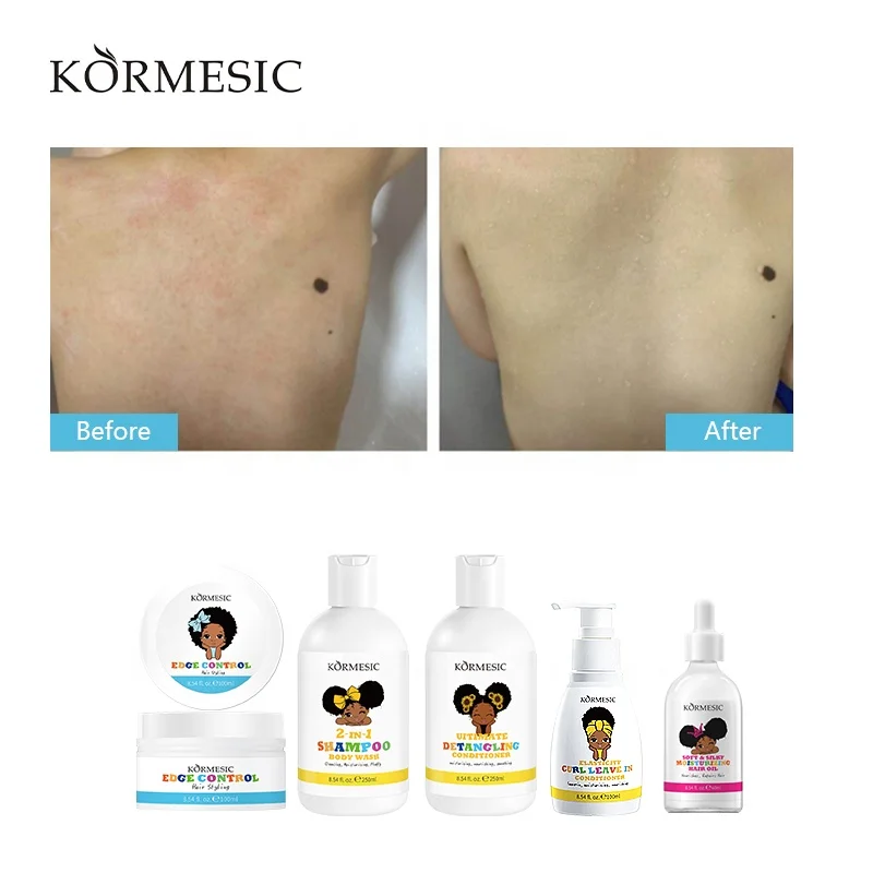 KORMESIC OEM & ODM Натуральный Детский ежедневный увлажняющий разглаживающий детский лосьон для тела