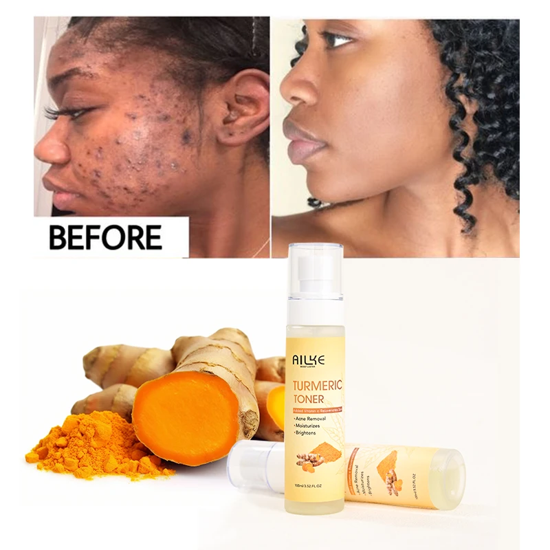 Oem Odm Tumeric Dark Spots Toner Spots Eraser Corrector Fades Blemishes Dark Spots Acne Remover Toner
