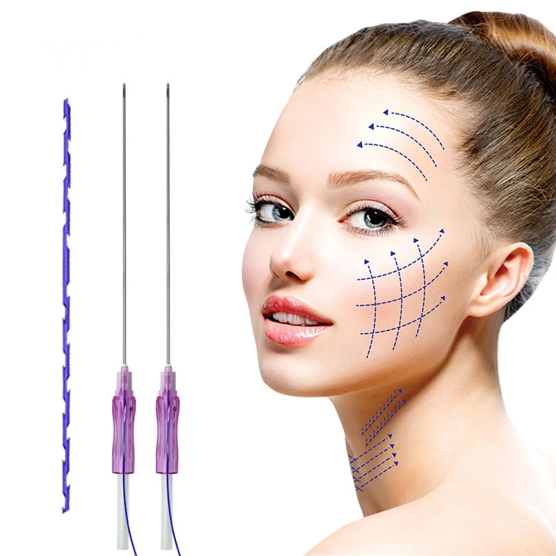 Molding 18G 100mm Thread lift face /pdo thread lifting thread