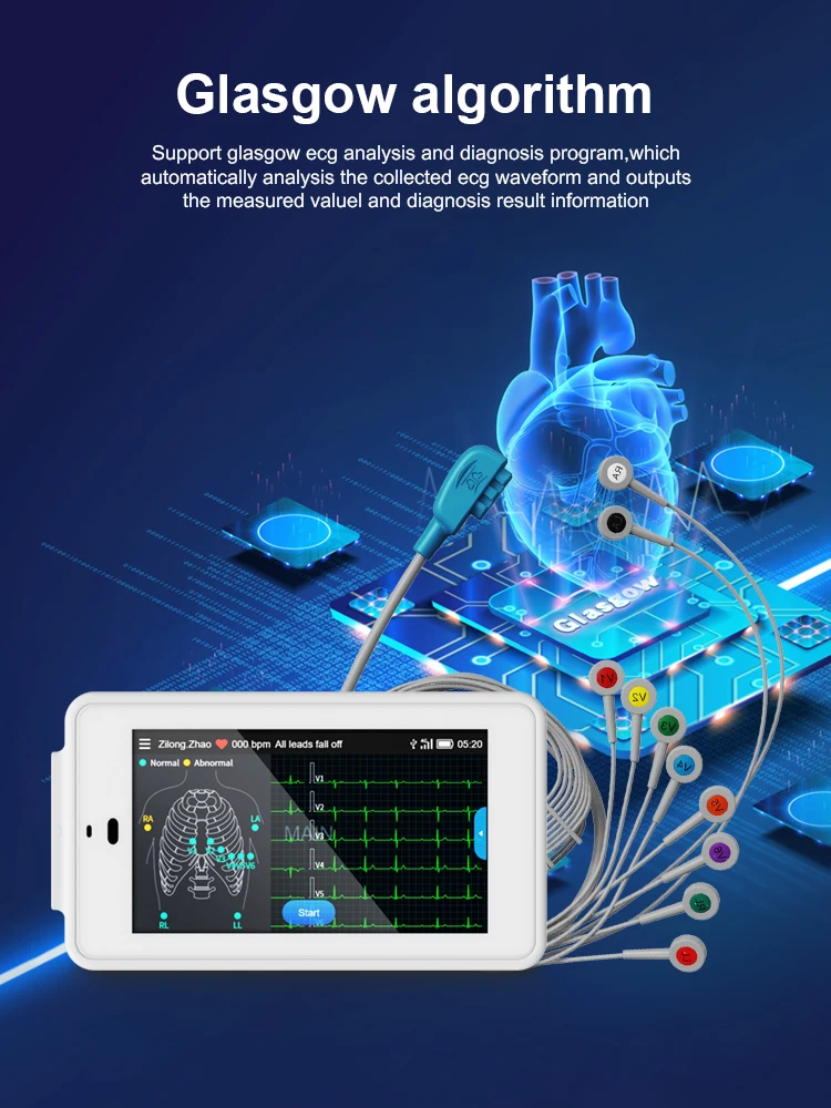 Wellue PCECG 500 24 Hours 12 Channel  ECG Device Electrocardiograma Wearables ECG