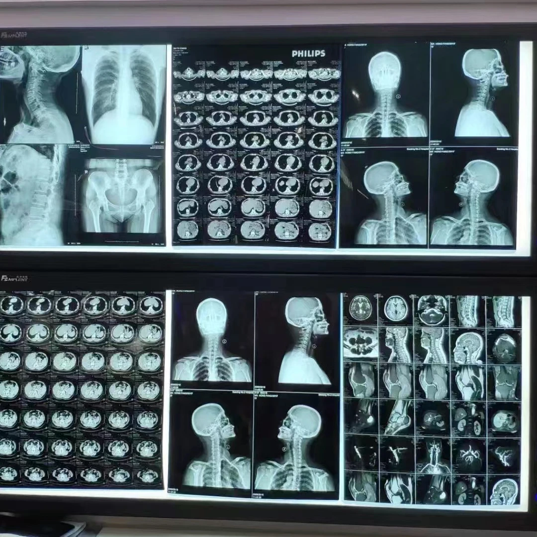 Blue Inkjet Medical Dry Film CT DR MRI X Ray Blue Transparent Film