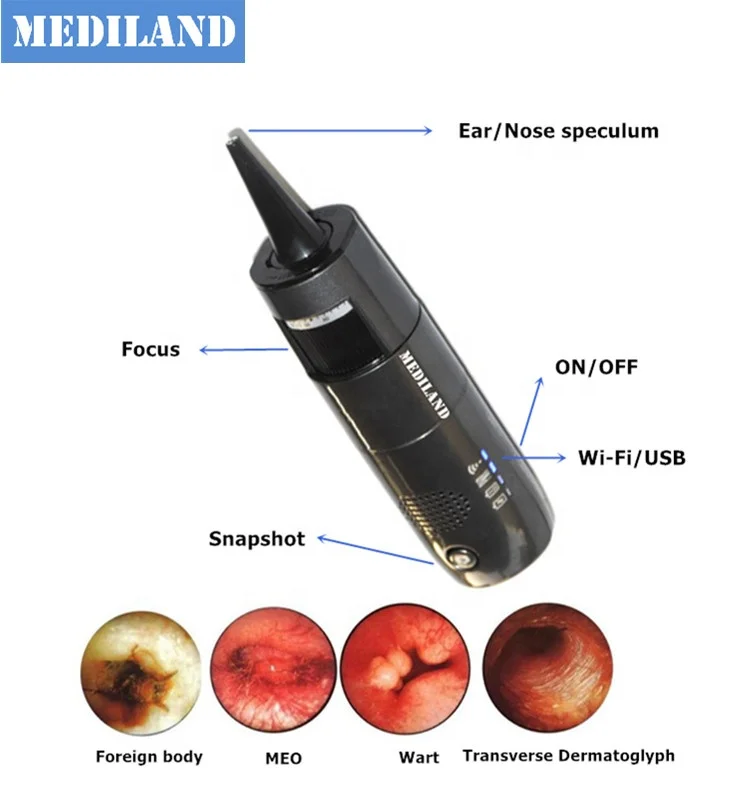 ML-OTN1 Otoscope set digital wifi microscope with USB mode HD video household wireless Endoscope to check ear and nose