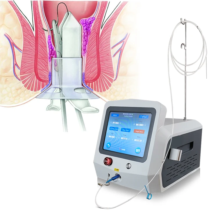 980nm 1470nm anal manometry laser proctology laser for hemorrhoids