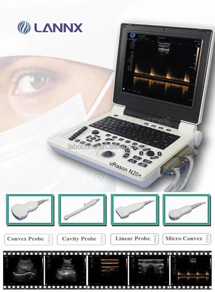 LANNX uRason N20+ Ecografo Digital Cardiac 2d 3d Ultrasound Scanner for pregnancy use USG Medical Echo Ultrasound Machine