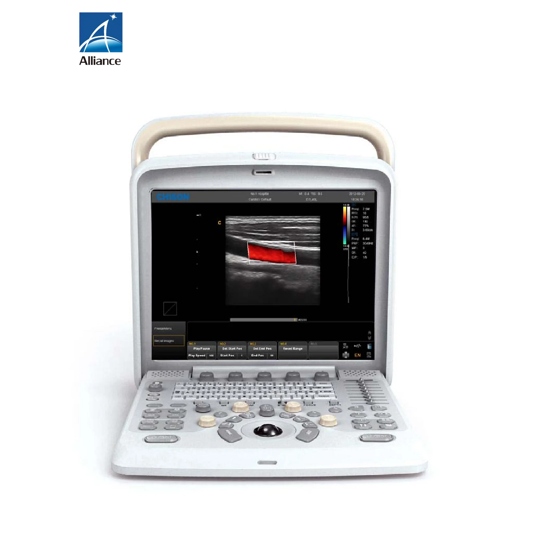 Chison Q9 Portable 4D Color Doppler Ultrasound USG 15inch High resolution color LCD