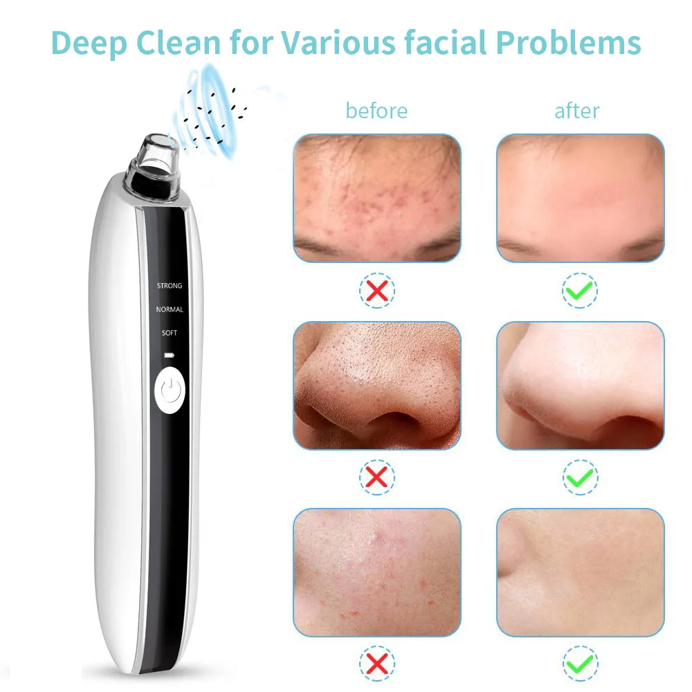 Visual HD Pore WIFI Visible Electric Pore Cleaner Lifting Moisturizing Vibration Face Tool Visual Blackhead Remover Vacuum