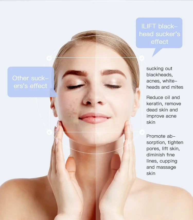 Лучшее вакуумное устройство для лечения угревой сыпи нанесение на нос с USB-разъемом небольшой колпачок омоложения кожи