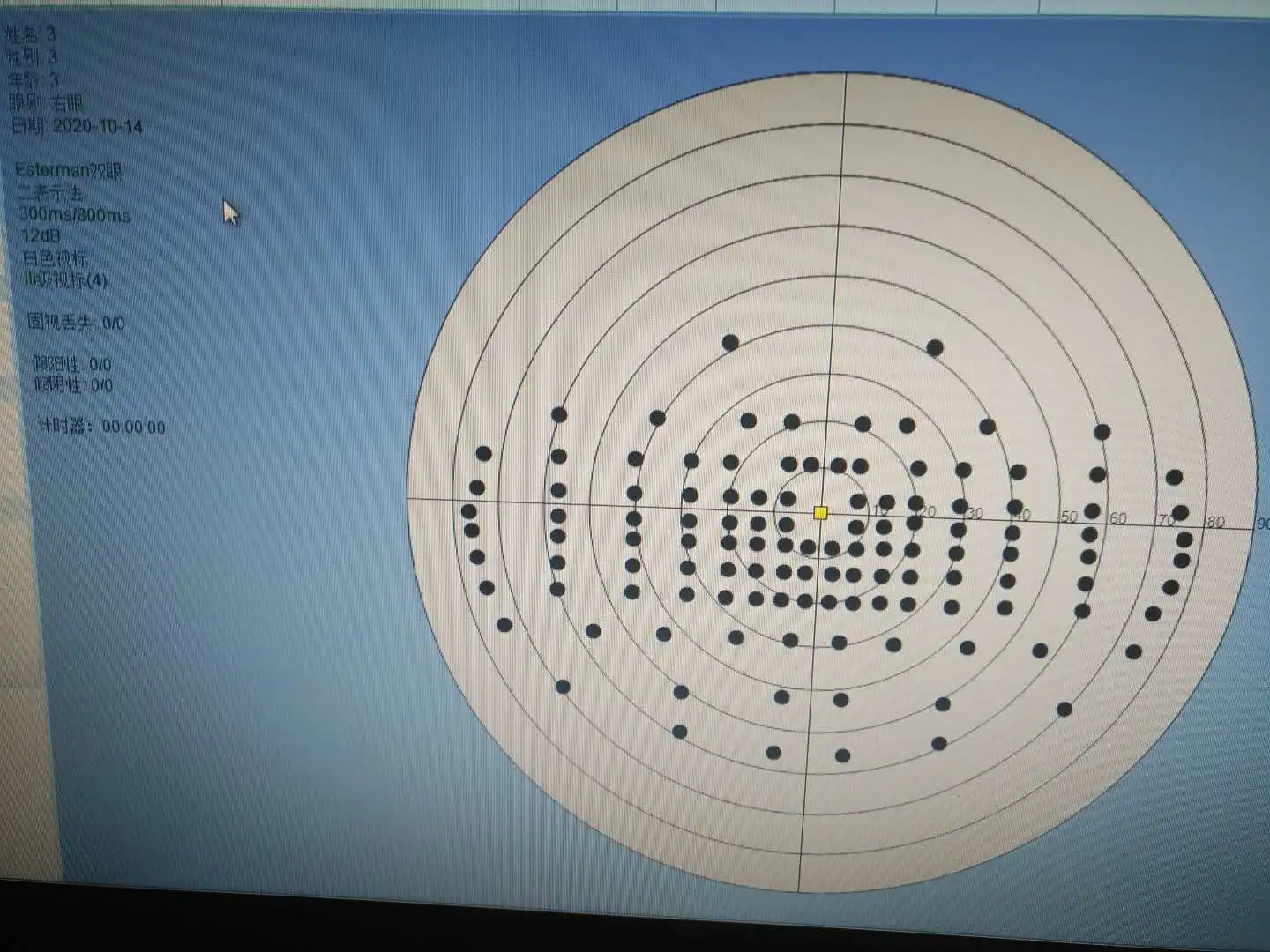 eastman double eye.jpg
