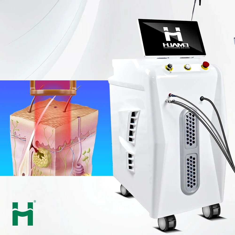 Candle 1064nm nd yag laser 755nm fiber alexandrite laser hair removal 2024 laser 755 alex alexandrite hair removal machine