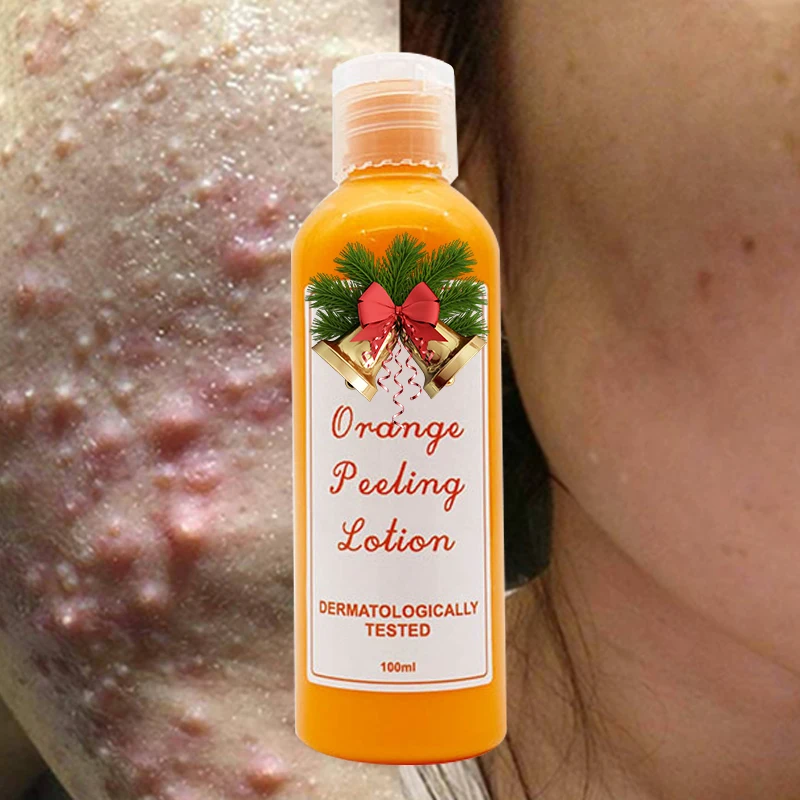 Private Label Aha Bha Black Skin Peel Orange Peeling Lightening Whitening Body Lotion