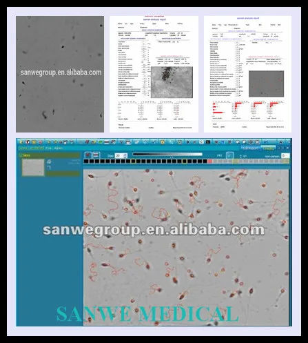 Auto Lab Semen Analyzer / CASA Software / SW-3702 Computer Aided Sperm Analyzer