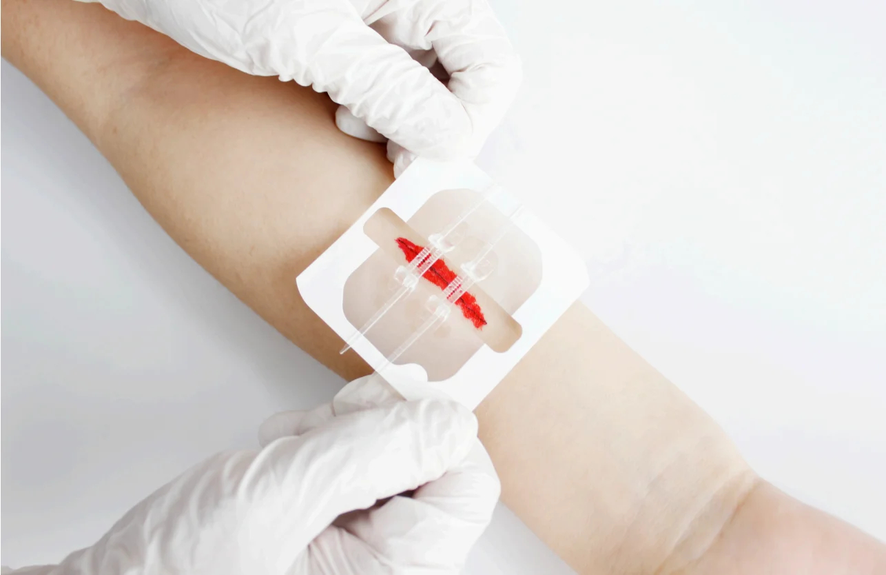 Medical Sterile Skin Closure Device Noninvasive Zip Without Stitches Sterile Strips Without Threads Dressing Wound Closure Strip