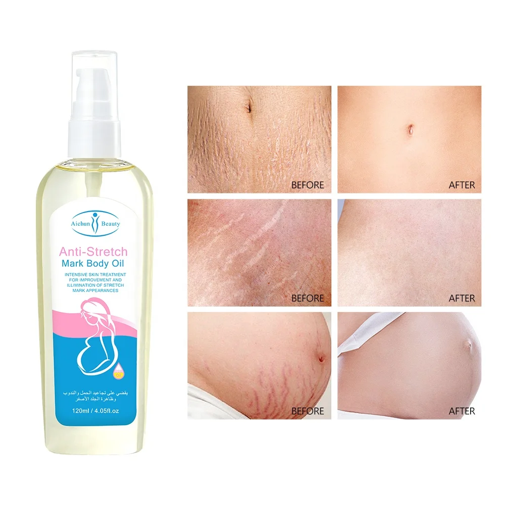 Private Label Stretch Mark Oil Essential Oil Effective Removal Scar Stretch Mark 100% Natural Stretch Mark Oil