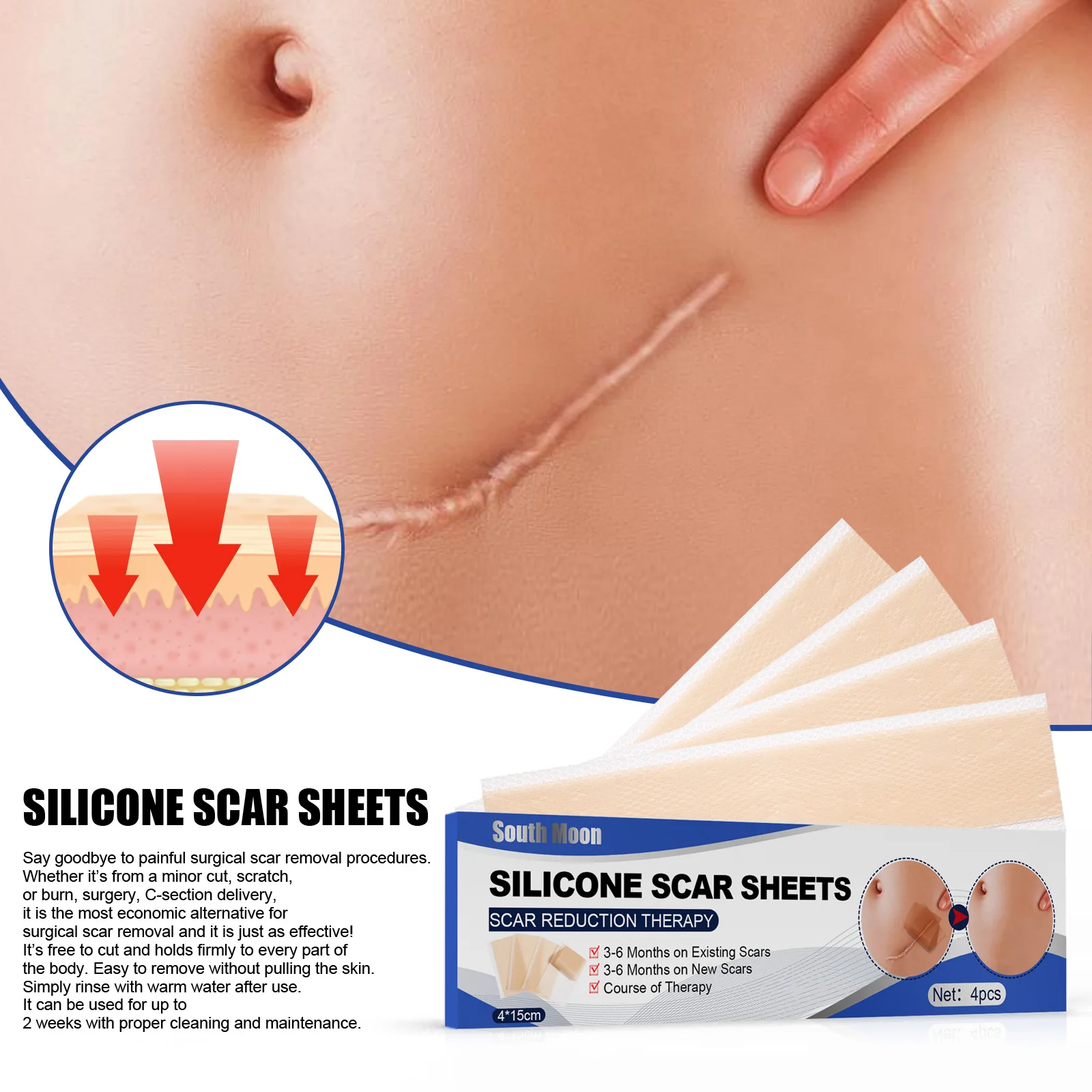 South Moon Silicone Patch Scars Scar Away Gel Sheets Silicone Scar Removal Sheet with size 7.5*4cm