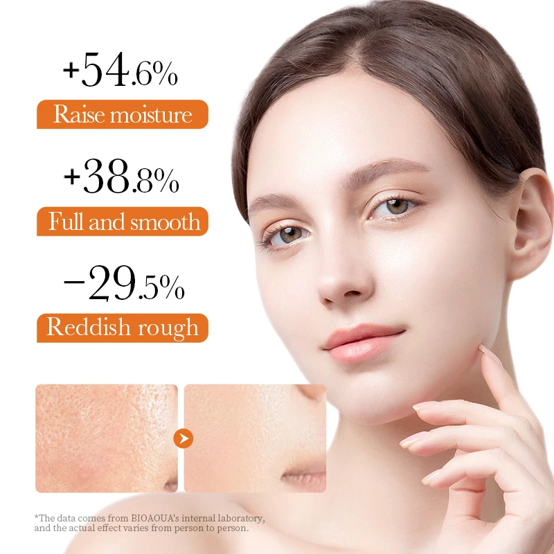 SADOER Wholesale Face Lotion Turmeric Anti-Acne Moisturizing Brightening Repair Smooth Skin Care Facial Milk Cosmetic Products