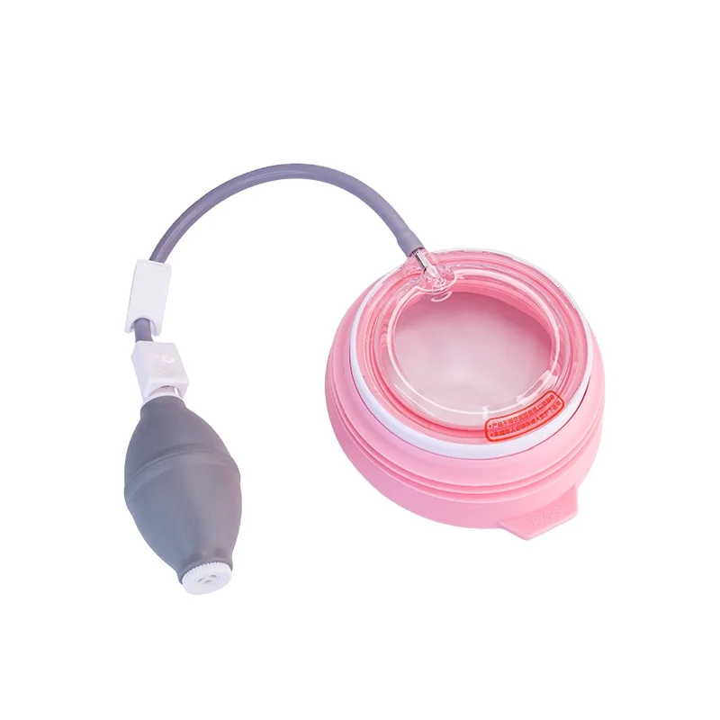 Suction Cup Vacuum Bell Non-Surgical Option to Treat Pectus Excavatum