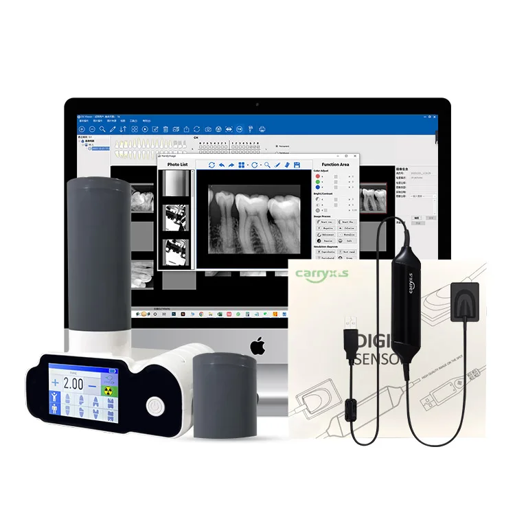 Touch type Battery 2mA 70KV Portable Digital Dental X Ray Machine