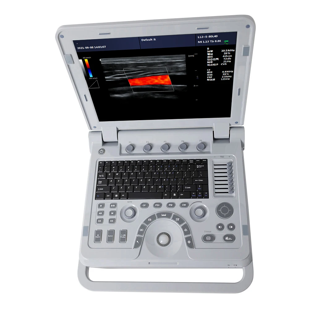 CONTEC CMS1700A-VET Color Doppler veterinary ultrasound table trolley ultrasound scanner