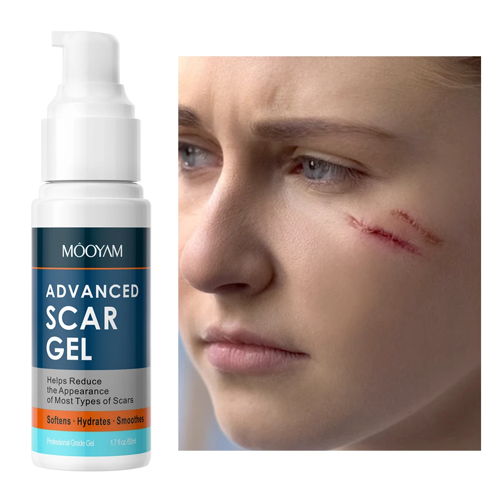 Private Label Fastest Scar Removal Gel Bruises Repair Reduce the Appearance of Most Types of Scars 50ml Removal Scar Gel