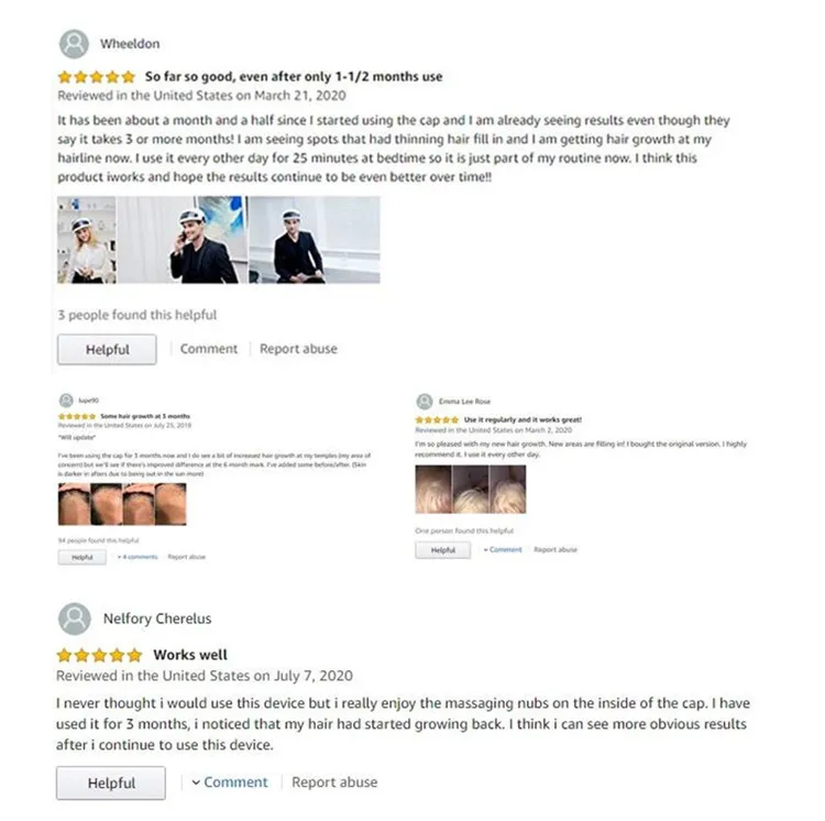 hair growth helmet effect.jpg