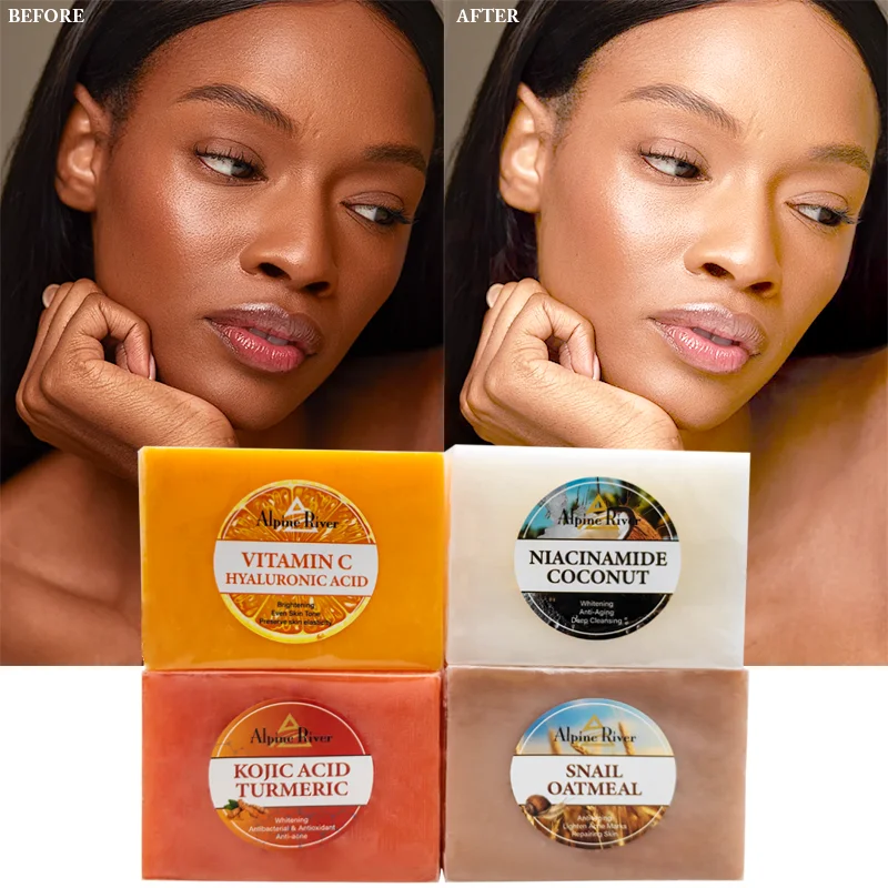 Private Label Vitamin C Skin Whitening Even Skin Tone Niacinamide Handmade Soap Exfoliating Skin Brightening Kojic Acid Soap