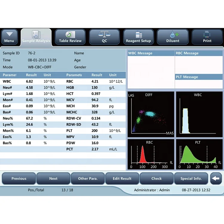 5 part diff Auto hematology analyzer WBC hematology analyzer-ZK-MR-BC-5000