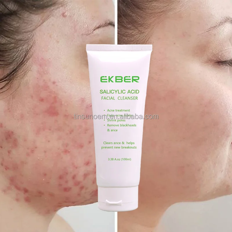 acne treatment men face wash facial cleanser clean and clear Fade acne marks Acne treatment azelaic acid face wash