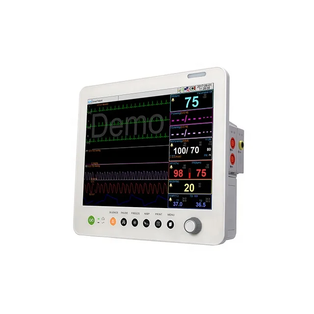 Multifunctional modular plug-in 17-inch touchscreen portable multi-parameter patient monitor