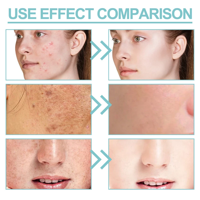 EELHOE silk protein skin repair face soap whitening acne repairing spot removing natural body soap bath and body works hand soap