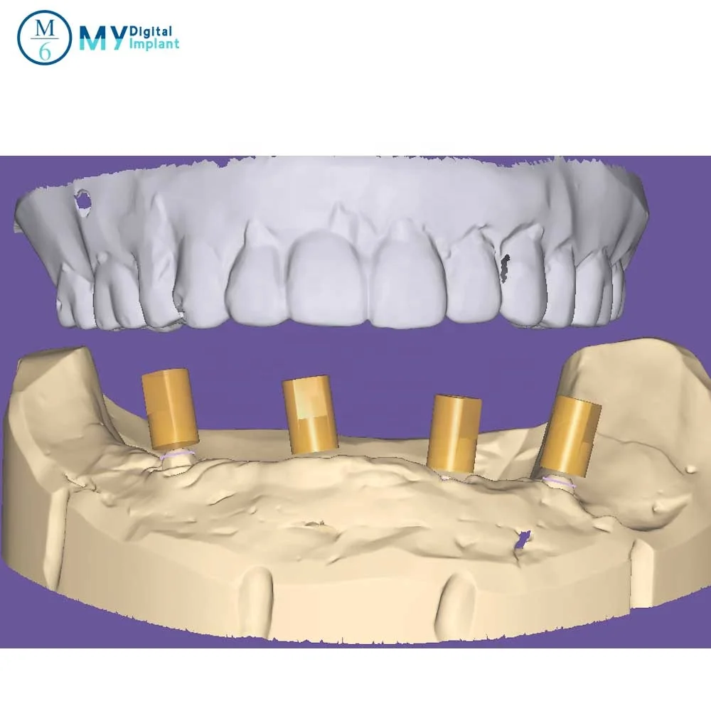 M6 CE certificated biohorizons implant compatible dental scan abutment