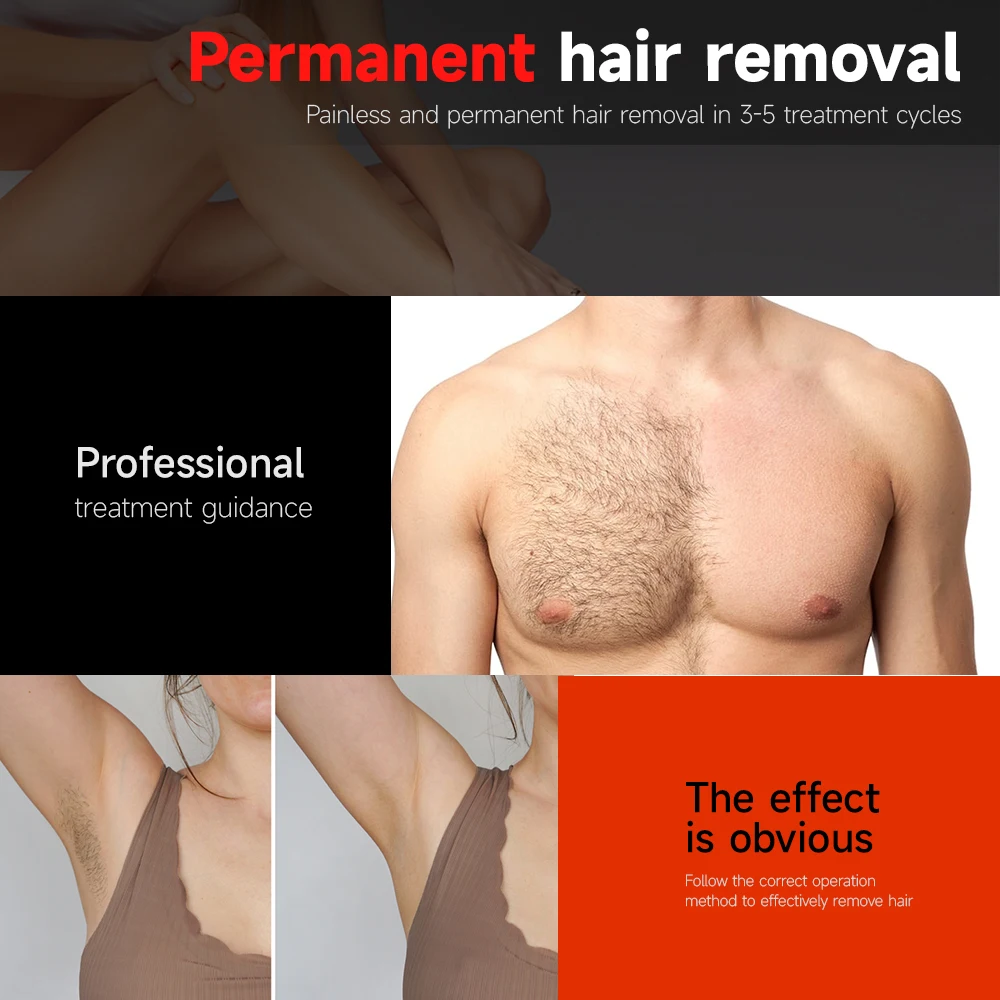 4-in-1 808nm Diode Laser Machine 3000W Stationary Hair Removal with 4 Adjustable Wavelengths and Spot Size for Optimal Results