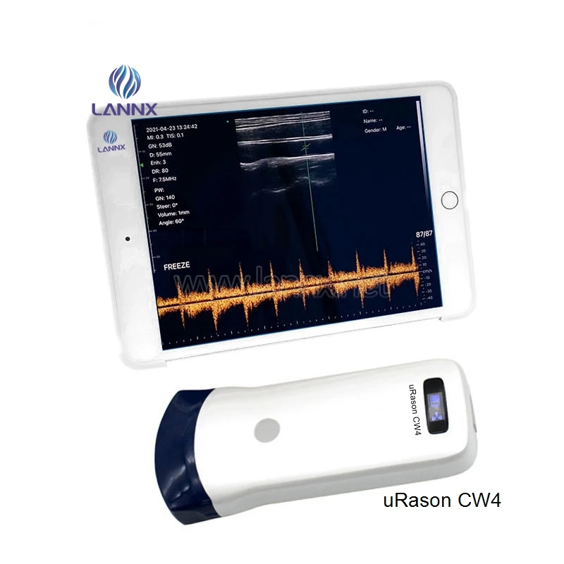 LANNX uRason CW4 Cheapest Wifi Ultrasound Probe Scanner 128 Elements Portable Color Doppler Wireless Ultrasound Probe Machine