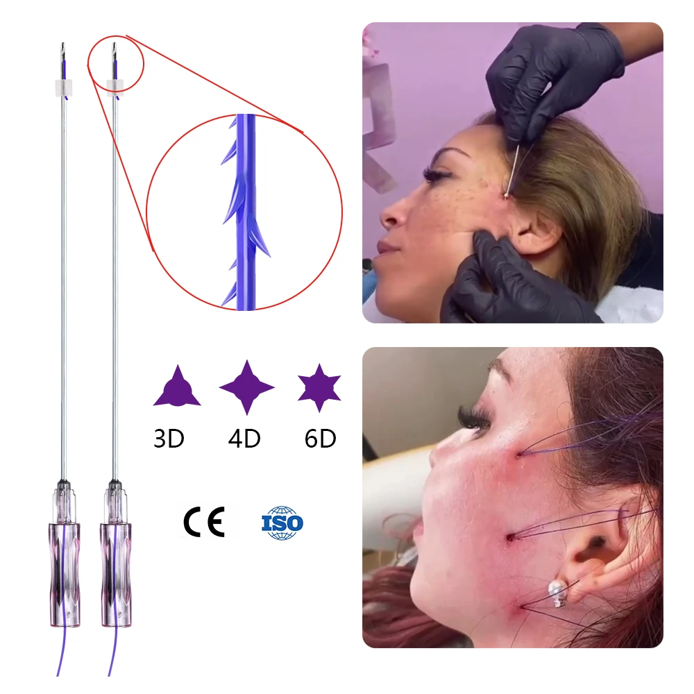 Ce Approval Absorbable 19g 120mm Neck Face Lifting Hilos Tensores Pcl Thread 3d 4d 6d Pdo Cog Threads