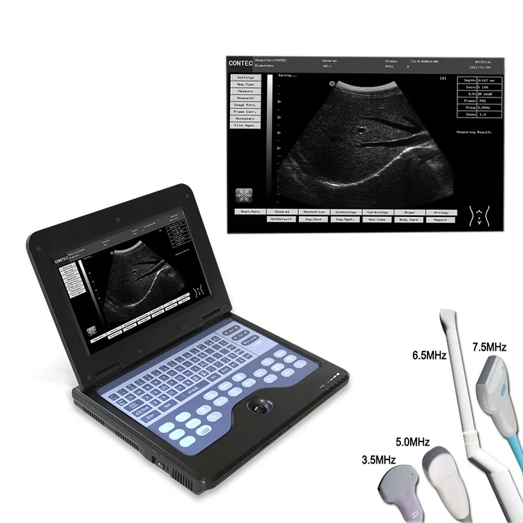 Portable vet clinic veterinary  ultrasound scanner veterinary  medical equipment