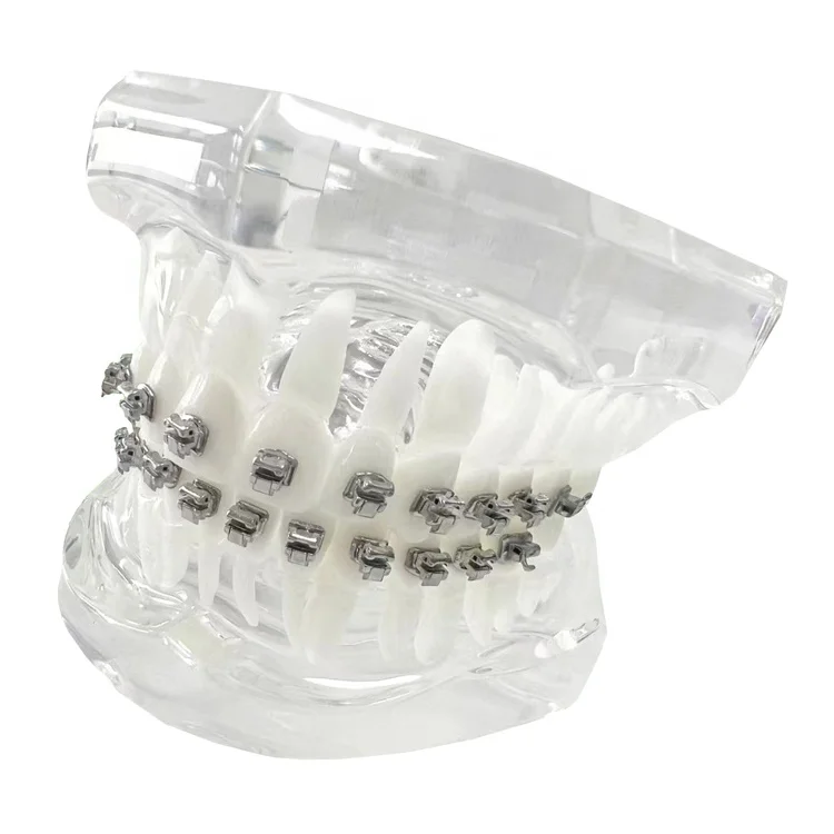 factory wholesale high quality dental product self locking orthodontic brackets self ligating mbt system