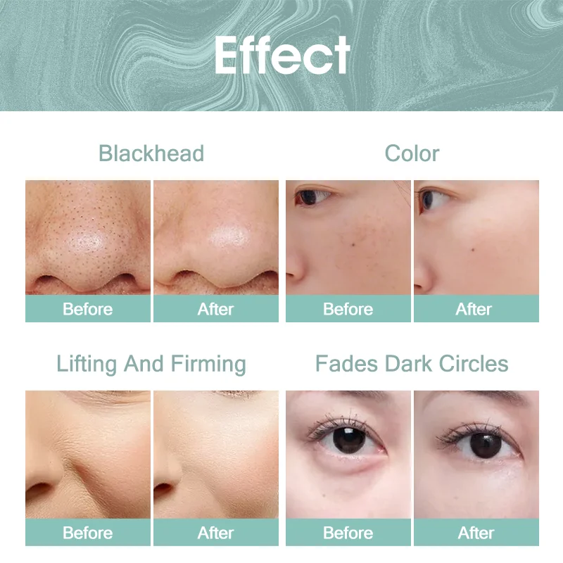 Factory Wholesale Small Bubbles Remove Pimples Clean Pores Machine Guangzhou Beauty Machine