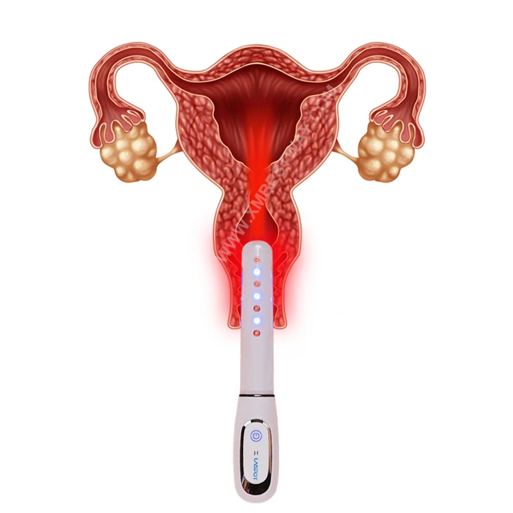 Female Health Vaginal Electrode Tightening Device Vibrator Soft Cold Laser Vagina Physical Therapy Equipment