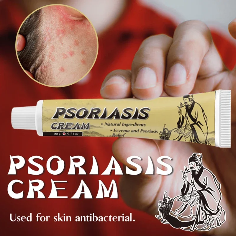 hot selling fungal infection skin psoriasis cream dermatitis eczema ointment treatment psoriasis cream skin cream