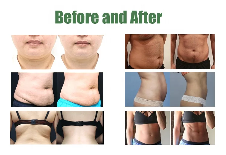 Body sculpting machines Cryo Body Shape Cryolipolysys 360 cryo Fat Cell Body Slimming 2 in 1 Machine