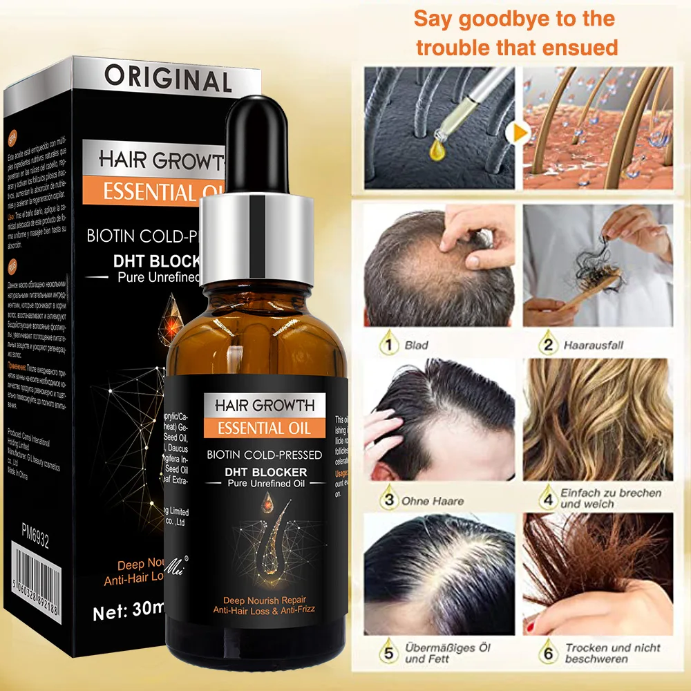 Wholesale anti hair loss treatment repairing Organ chair growth oil for black women private label