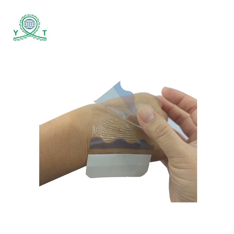 Yitong waterproof PU film Adhesive Wound Dressing