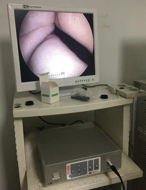 Medical surgical ent endoscope camera system for wholesales
