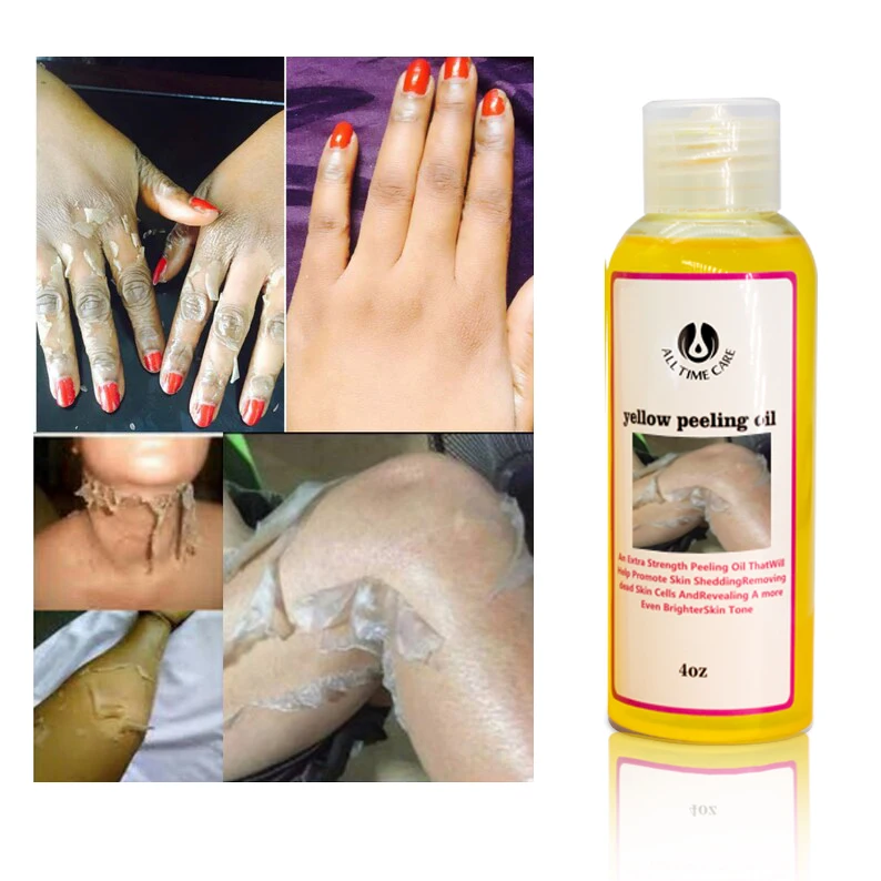 OEM Private Label Extra Strong Peeling Oil Whitening Yellow Peeling Oil