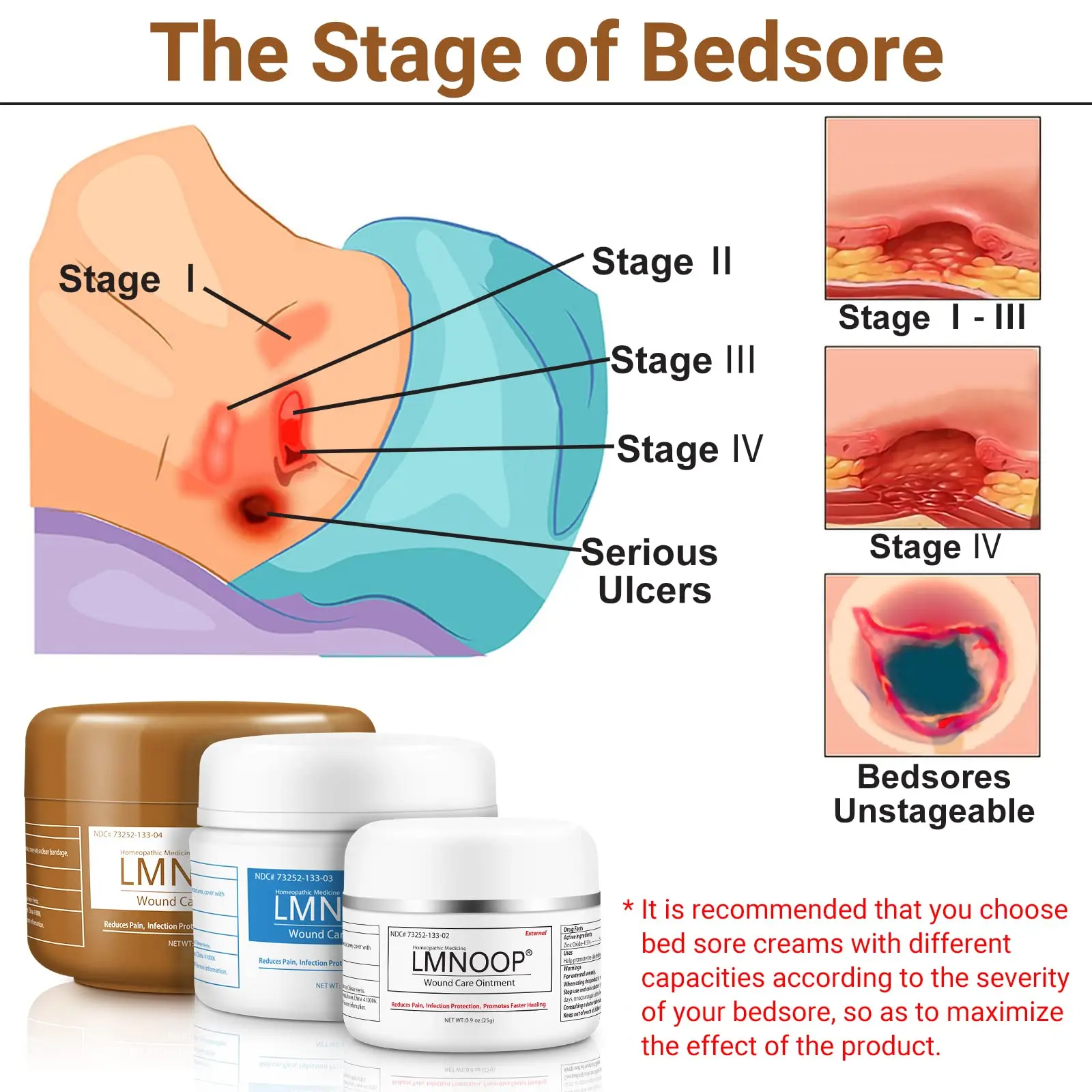 Lmnoop Wound Care Bandages Cold Laser Healing Apparatus Ointment Alginate Bed Sore Cream For Adults