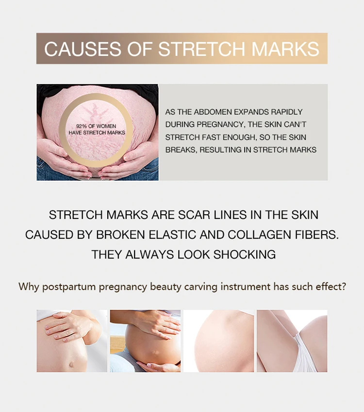 Essing Newest Innovation No-surgical For Beauty Center Stretch Mark Removal Machine